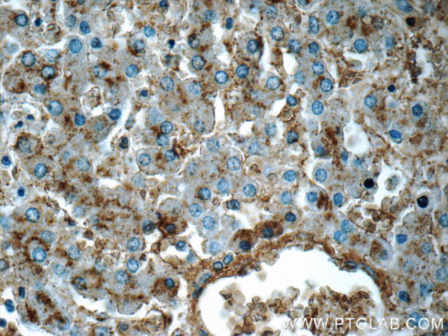 CHKA Antibody in Immunohistochemistry (Paraffin) (IHC (P))