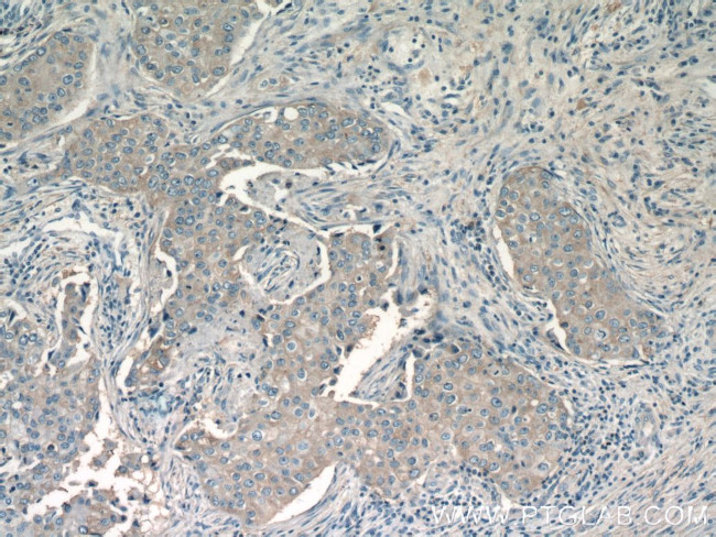 CHKA Antibody in Immunohistochemistry (Paraffin) (IHC (P))