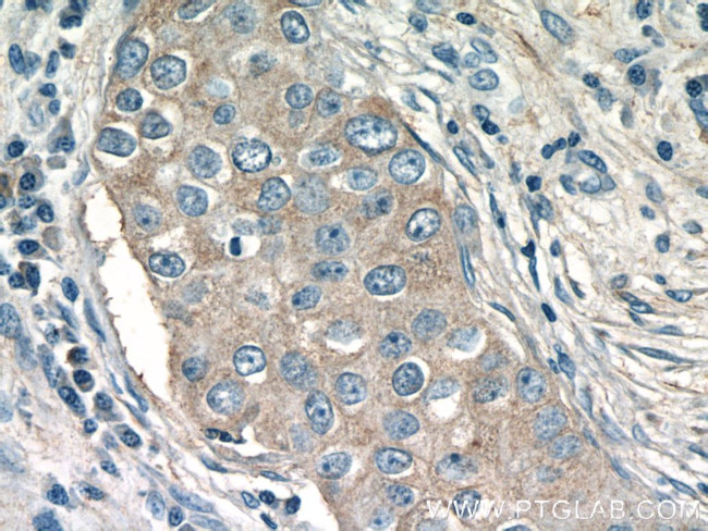 CHKA Antibody in Immunohistochemistry (Paraffin) (IHC (P))