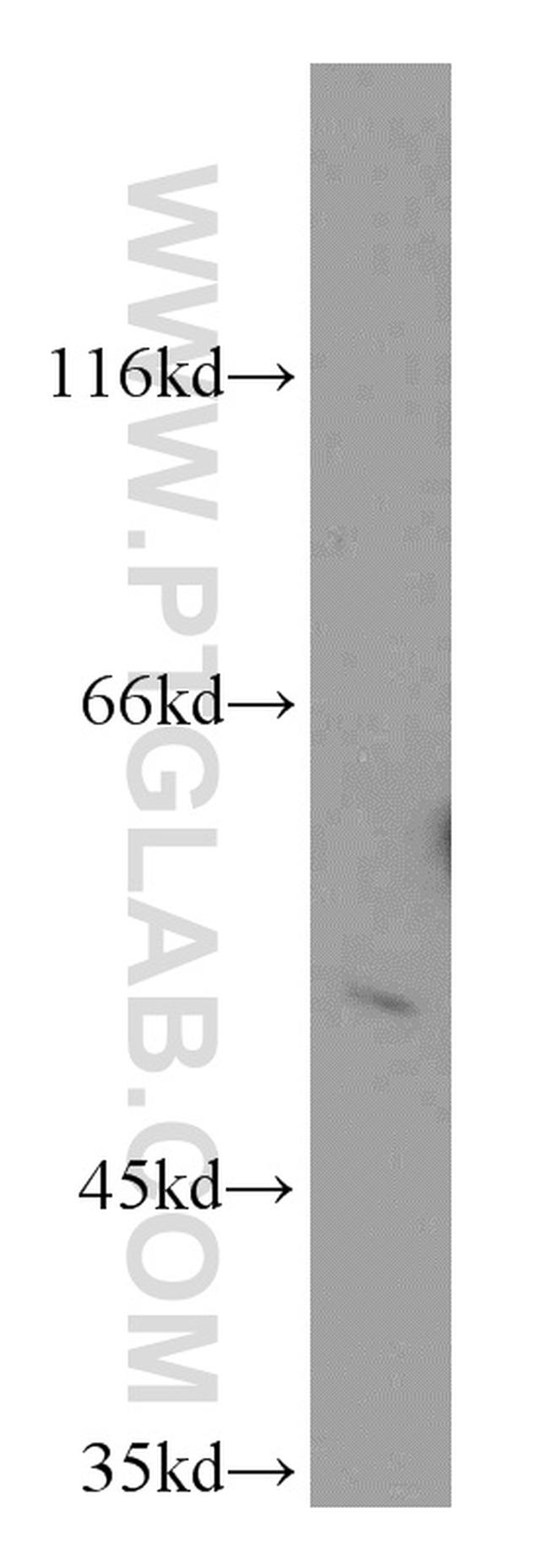 CHKA Antibody in Western Blot (WB)