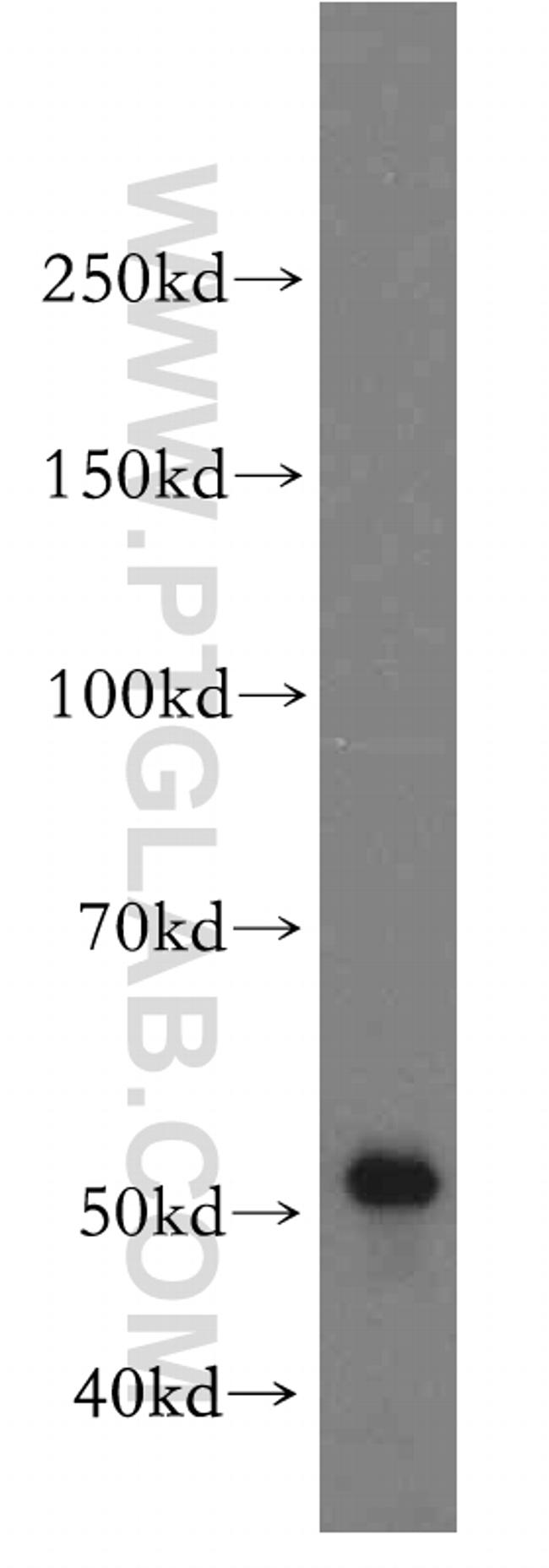 CHKA Antibody in Western Blot (WB)