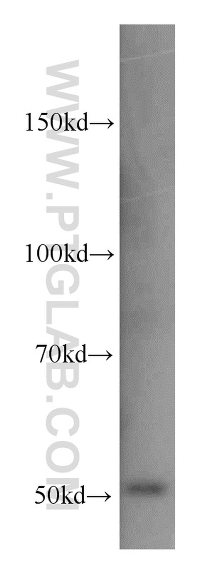 CHKA Antibody in Western Blot (WB)