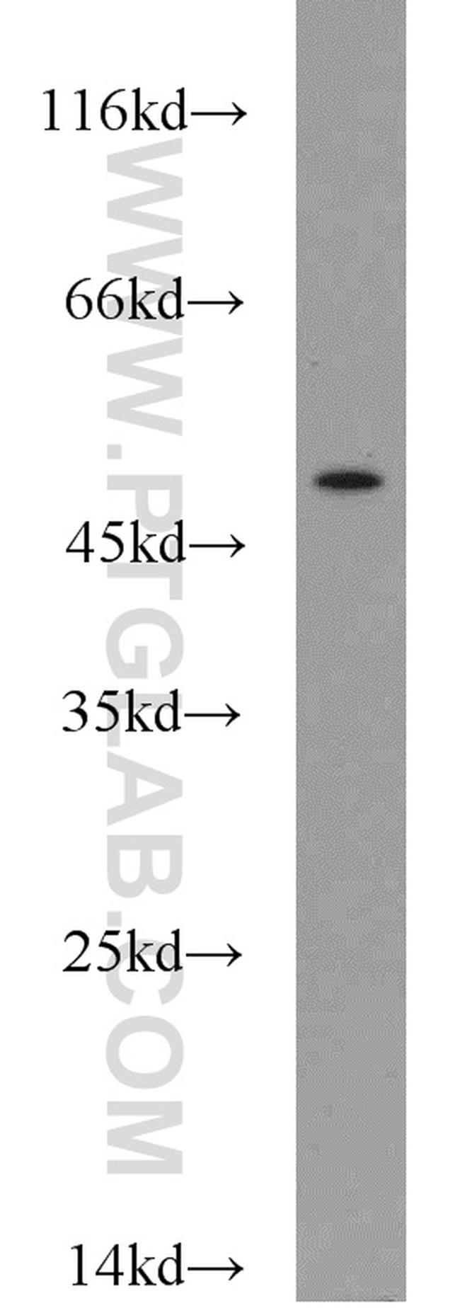 CHKA Antibody in Western Blot (WB)