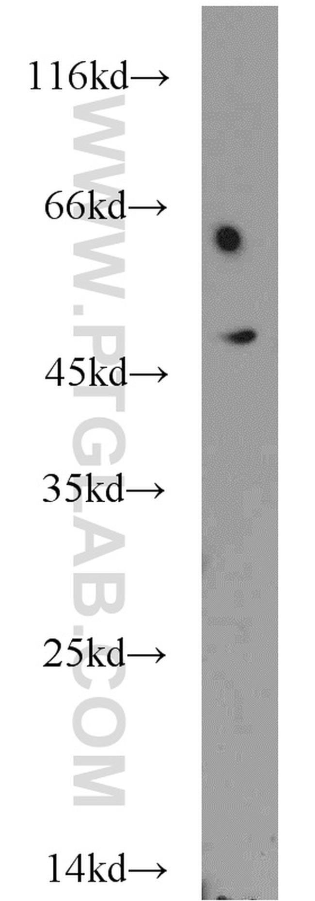 CHKA Antibody in Western Blot (WB)