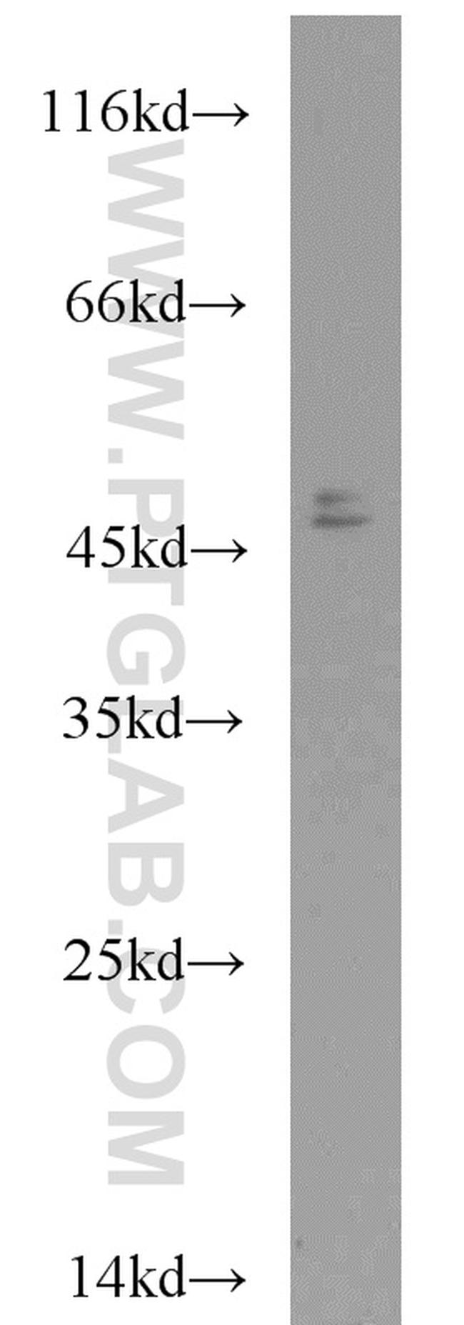 CHKA Antibody in Western Blot (WB)