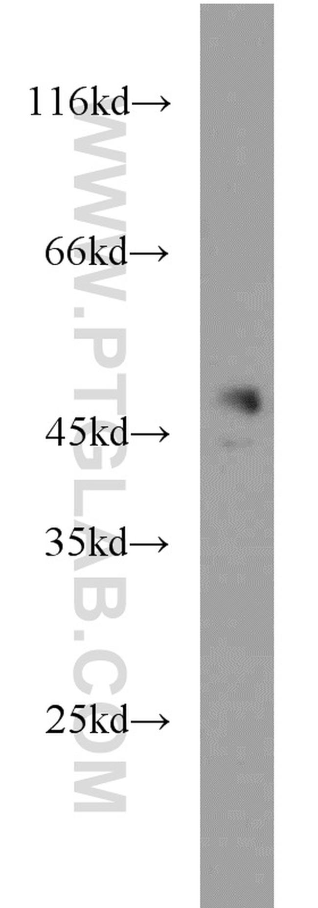 CHKA Antibody in Western Blot (WB)