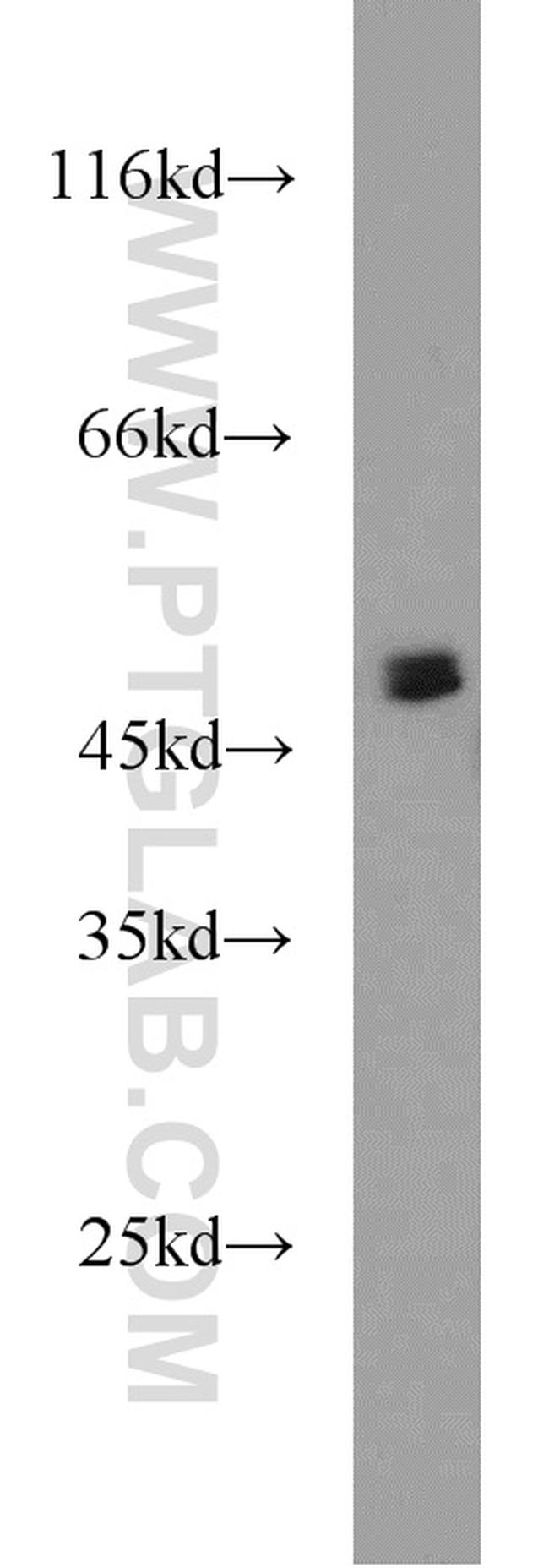 CHKA Antibody in Western Blot (WB)