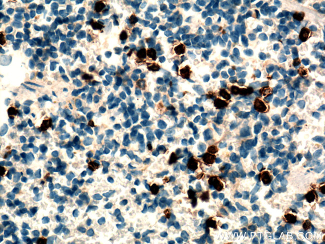 Cxcr2 Antibody in Immunohistochemistry (Paraffin) (IHC (P))