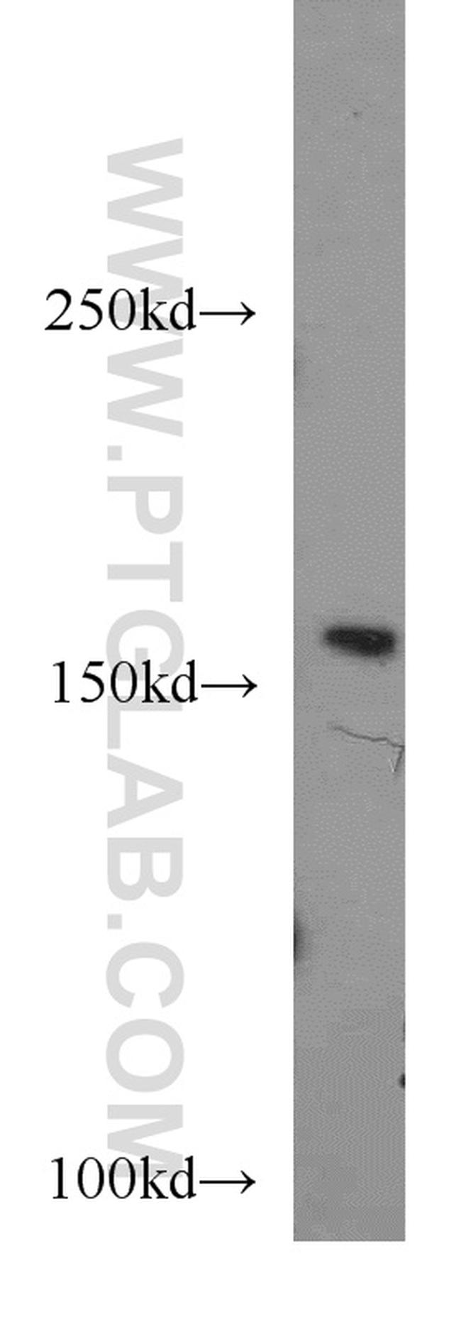 FANCA Antibody in Western Blot (WB)