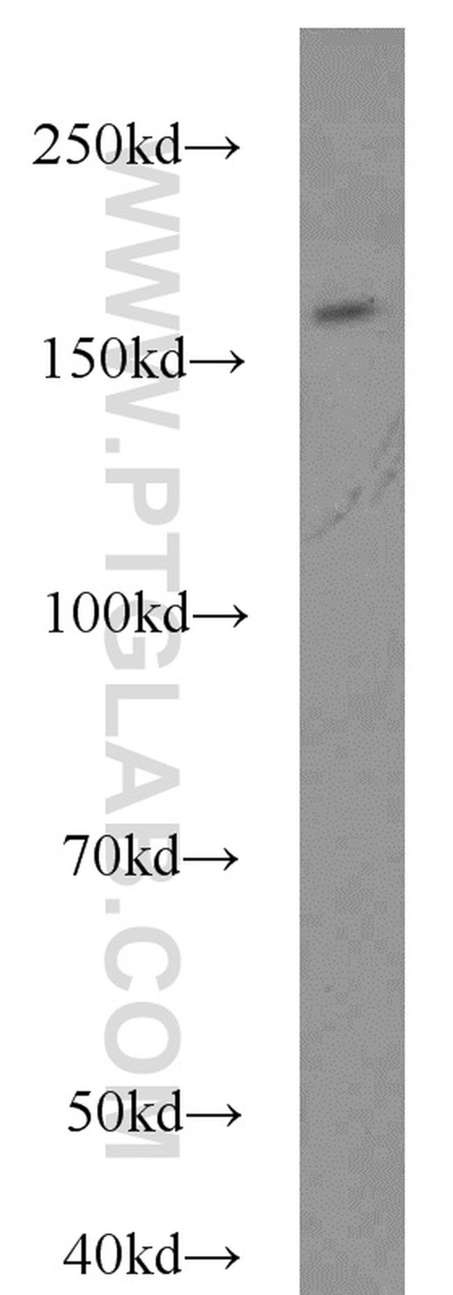 FANCA Antibody in Western Blot (WB)