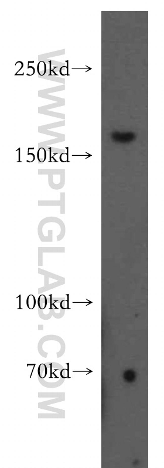 FANCA Antibody in Western Blot (WB)