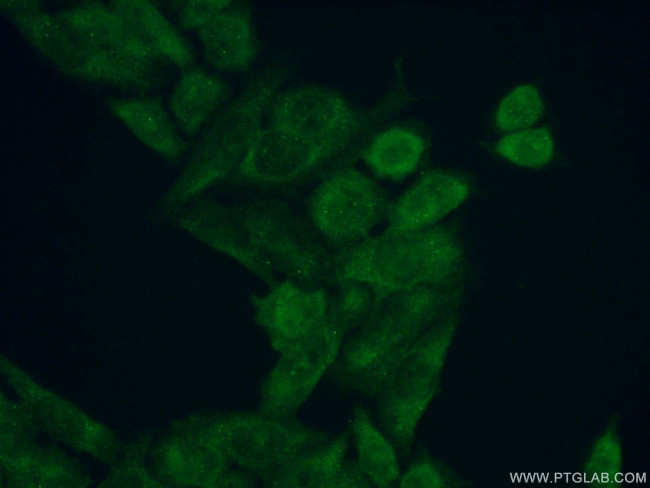 FEM1B Antibody in Immunocytochemistry (ICC/IF)