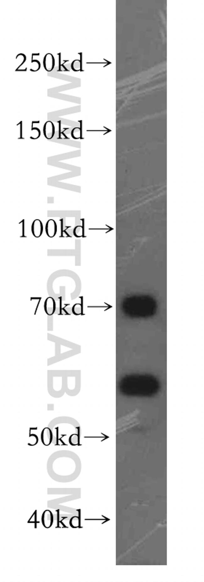 FEM1B Antibody in Western Blot (WB)