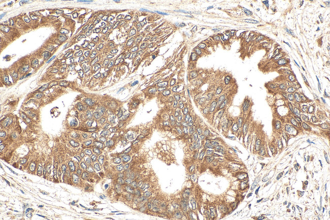 FEM1B Antibody in Immunohistochemistry (Paraffin) (IHC (P))