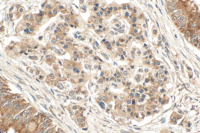 FEM1B Antibody in Immunohistochemistry (Paraffin) (IHC (P))