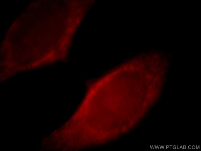 Myoferlin Antibody in Immunocytochemistry (ICC/IF)