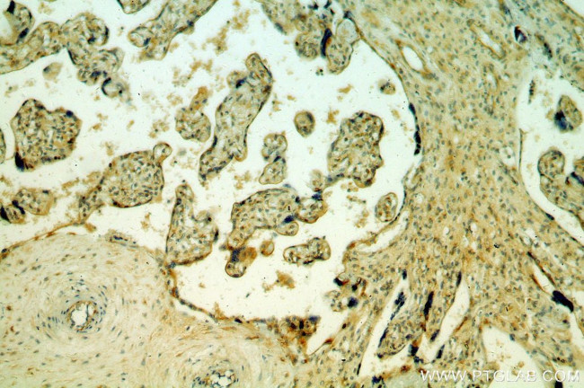 Myoferlin Antibody in Immunohistochemistry (Paraffin) (IHC (P))