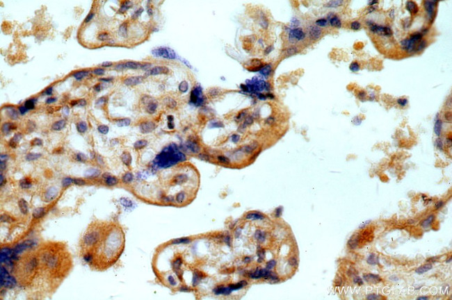 Myoferlin Antibody in Immunohistochemistry (Paraffin) (IHC (P))