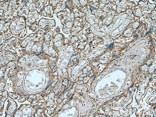 Myoferlin Antibody in Immunohistochemistry (Paraffin) (IHC (P))