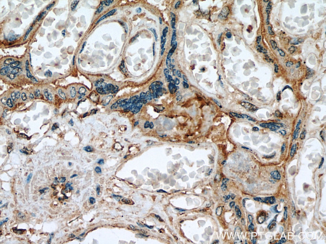 Myoferlin Antibody in Immunohistochemistry (Paraffin) (IHC (P))