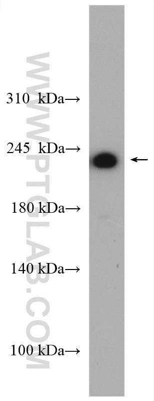 Myoferlin Antibody in Western Blot (WB)