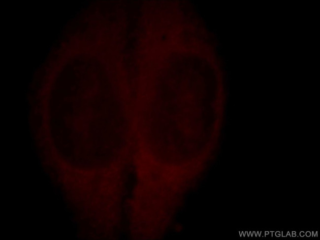 KIF19 Antibody in Immunocytochemistry (ICC/IF)