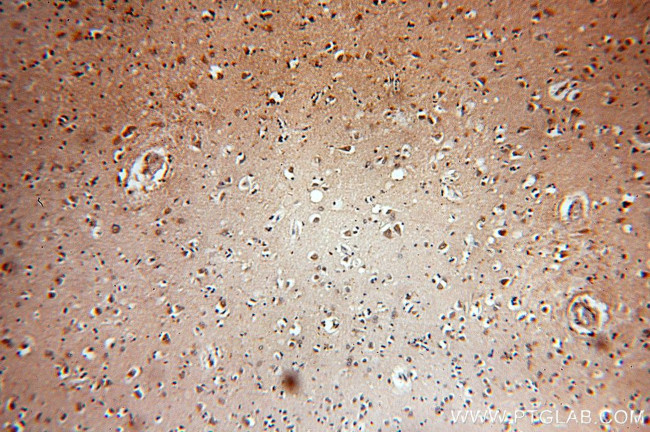 KIF19 Antibody in Immunohistochemistry (Paraffin) (IHC (P))