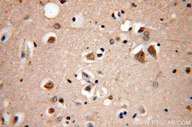 KIF19 Antibody in Immunohistochemistry (Paraffin) (IHC (P))