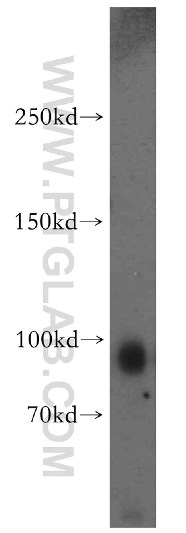 KIF19 Antibody in Western Blot (WB)