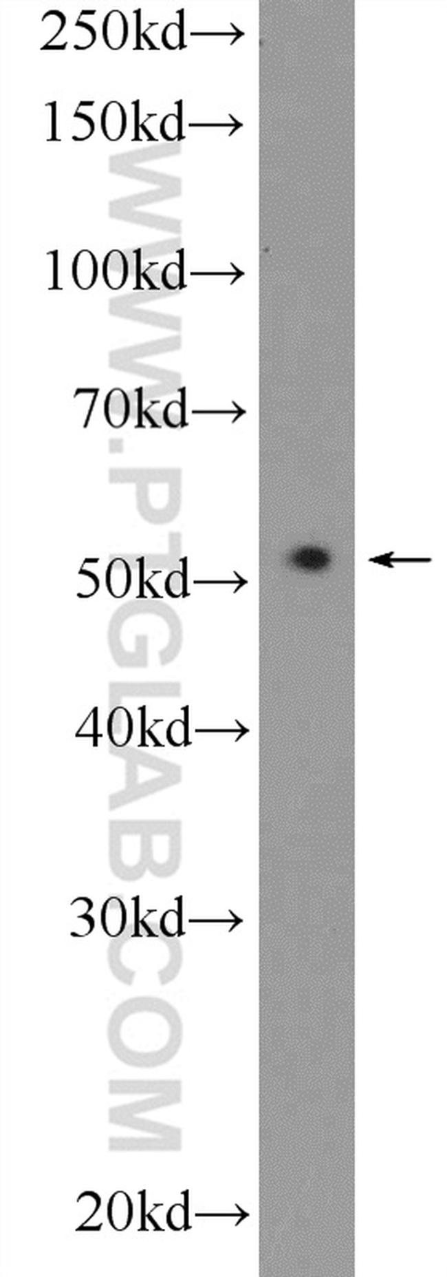 RUNX1 (N-terminal) Antibody in Western Blot (WB)