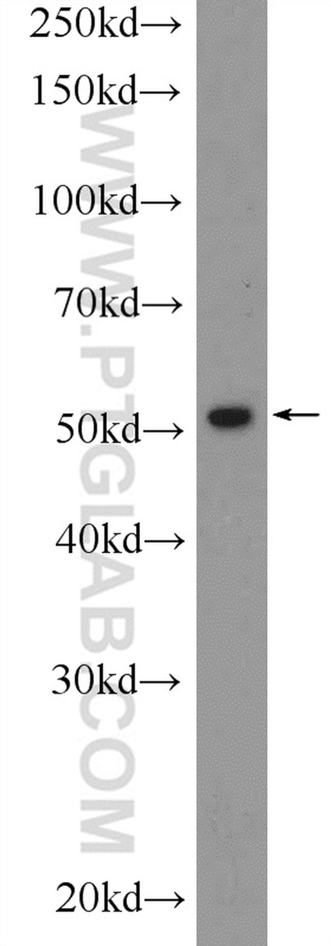 RUNX1 (N-terminal) Antibody in Western Blot (WB)