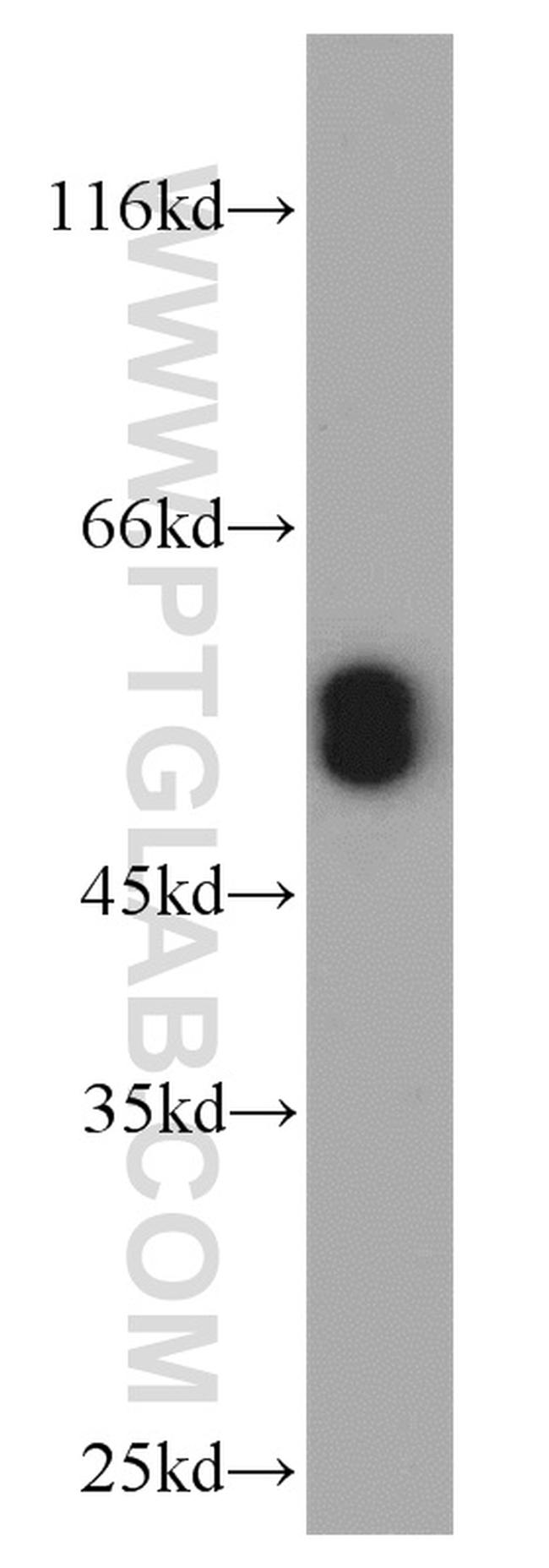 RUNX1 (N-terminal) Antibody in Western Blot (WB)