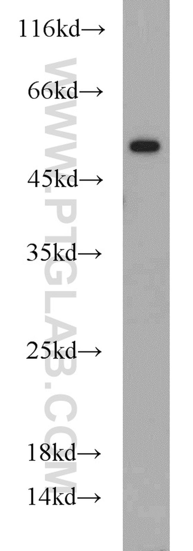 RUNX1 (N-terminal) Antibody in Western Blot (WB)