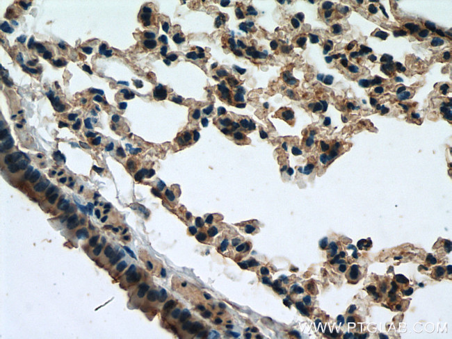 Serotonin transporter Antibody in Immunohistochemistry (Paraffin) (IHC (P))