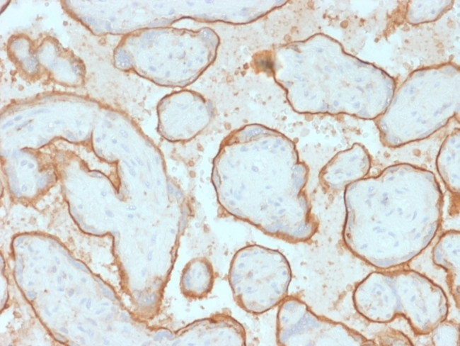 EGFRvIII (Epidermal Growth Factor Receptor, Variant III) Antibody in Immunohistochemistry (Paraffin) (IHC (P))