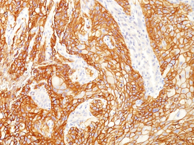 EGFRvIII (Epidermal Growth Factor Receptor, Variant III) Antibody in Immunohistochemistry (Paraffin) (IHC (P))