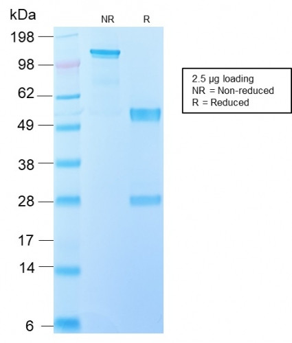 EGFRvIII (Epidermal Growth Factor Receptor, Variant III) Antibody in SDS-PAGE (SDS-PAGE)