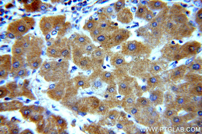 UBASH3B/STS 1 Antibody in Immunohistochemistry (Paraffin) (IHC (P))