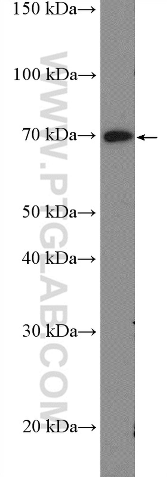 UBASH3B/STS 1 Antibody in Western Blot (WB)