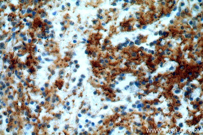 UBASH3B/STS 1 Antibody in Immunohistochemistry (Paraffin) (IHC (P))