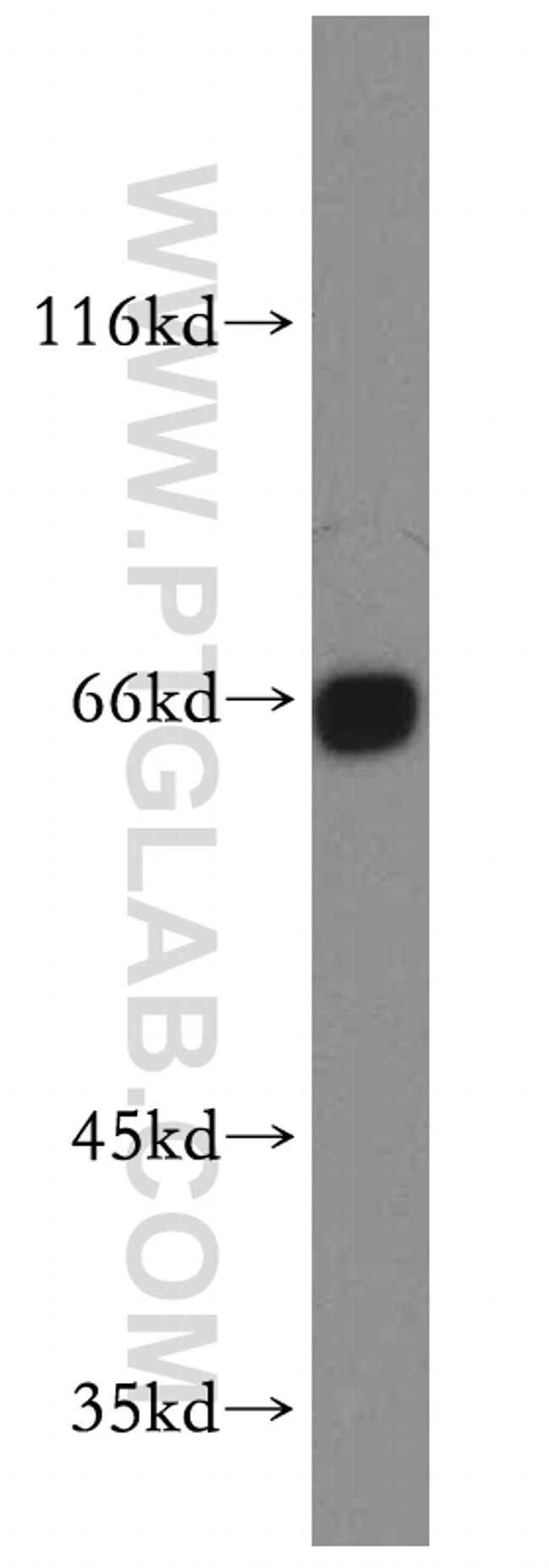 UBASH3B/STS 1 Antibody in Western Blot (WB)