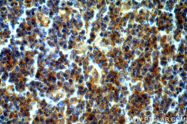 UNC45A Antibody in Immunohistochemistry (Paraffin) (IHC (P))