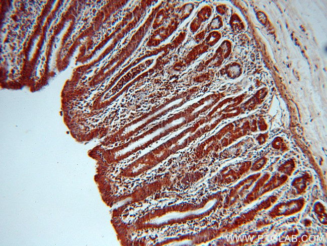 UNC45A Antibody in Immunohistochemistry (Paraffin) (IHC (P))