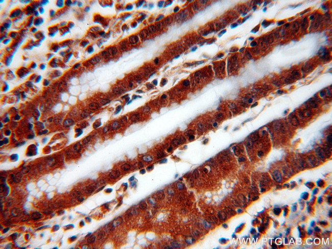 UNC45A Antibody in Immunohistochemistry (Paraffin) (IHC (P))