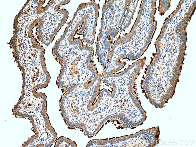 UNC45A Antibody in Immunohistochemistry (Paraffin) (IHC (P))