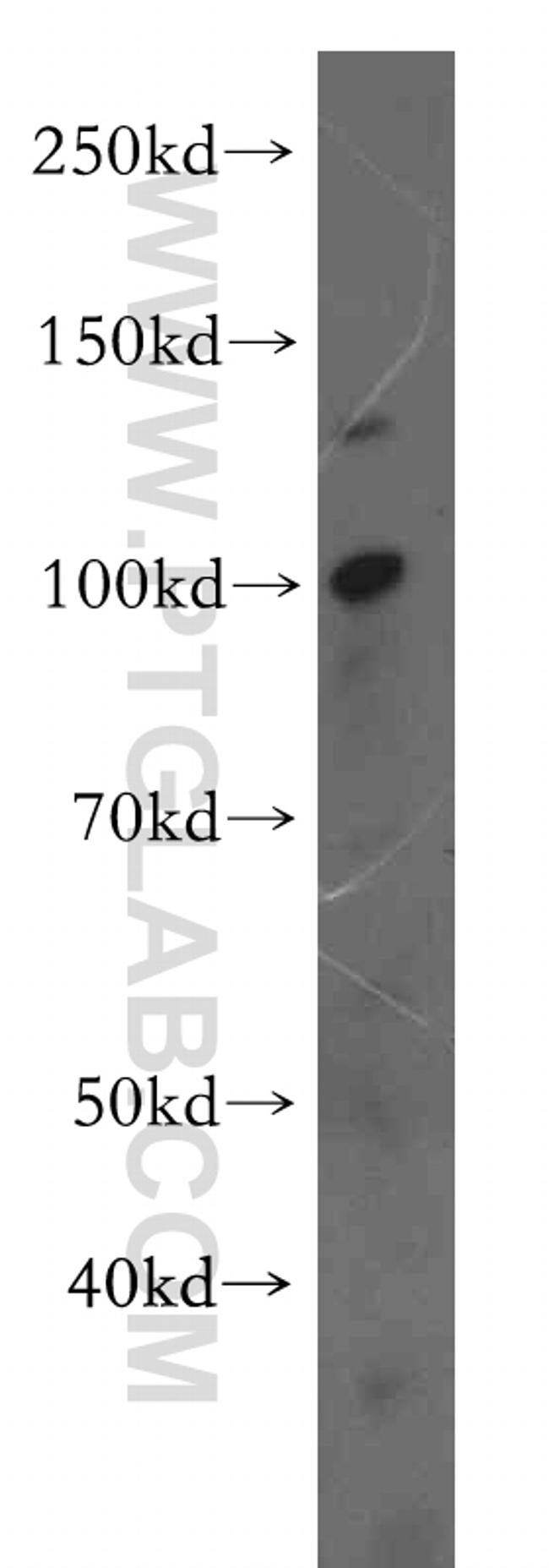 UNC45A Antibody in Western Blot (WB)