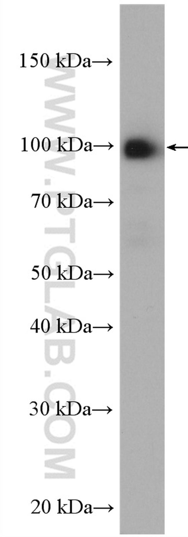 UNC45A Antibody in Western Blot (WB)