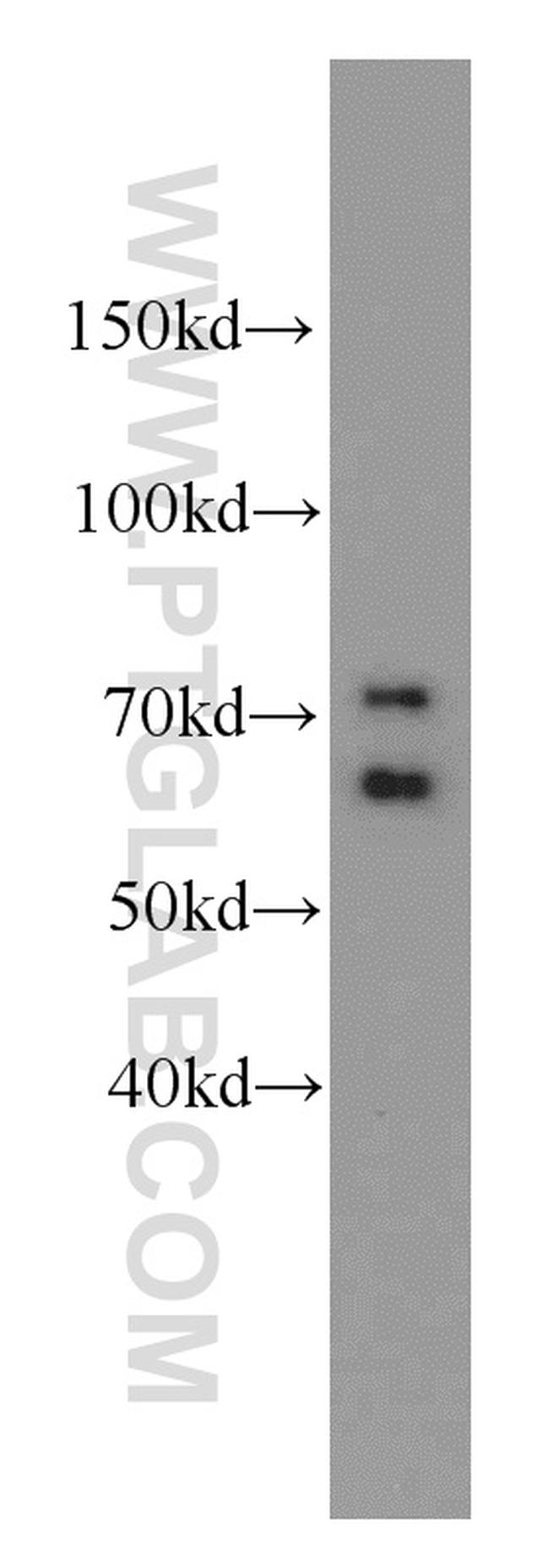 MCM-BP Antibody in Western Blot (WB)