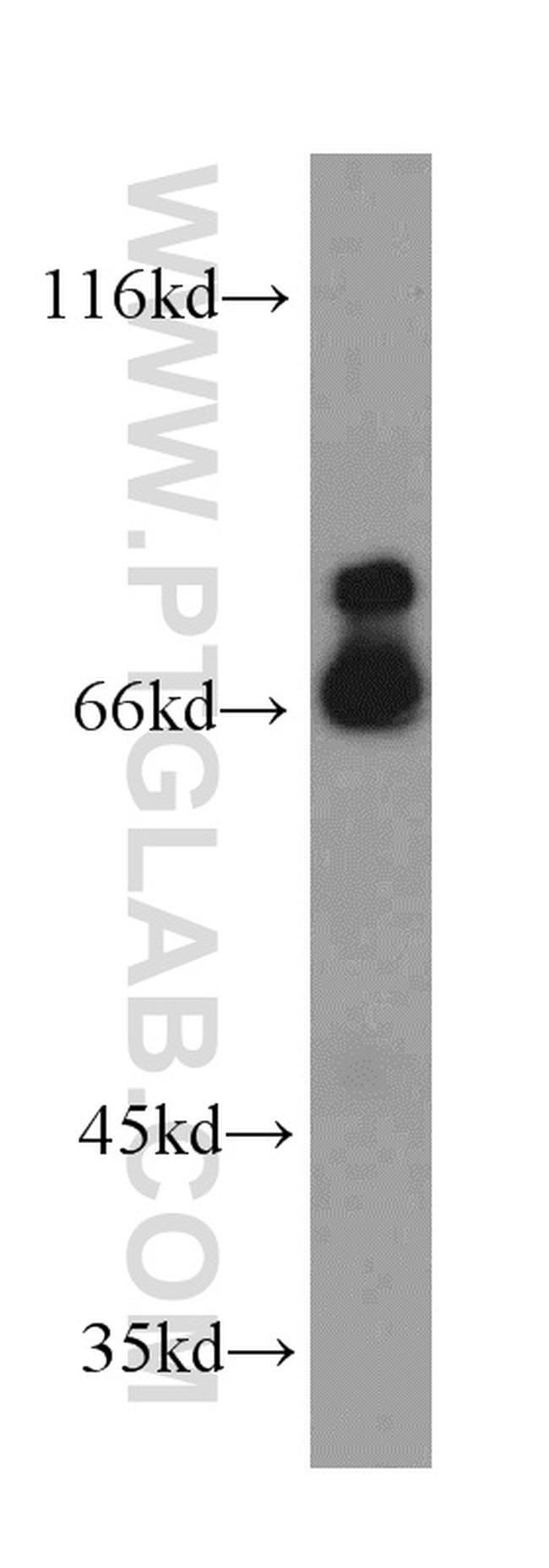 MCM-BP Antibody in Western Blot (WB)