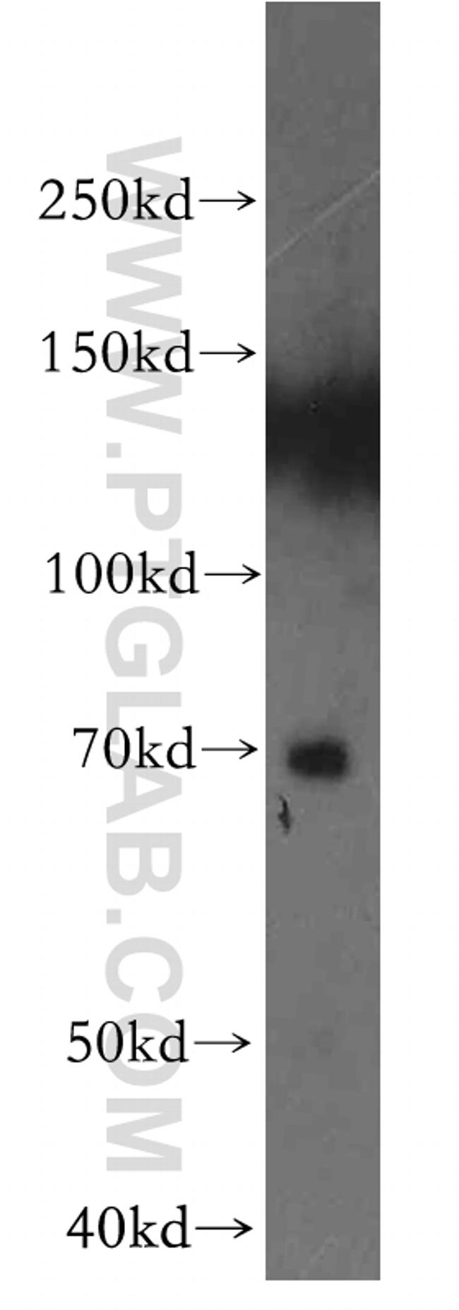 ENTPD4 Antibody in Western Blot (WB)
